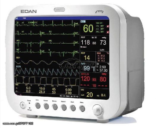Φορητό μόνιτορ παρακολούθηση Edan M9