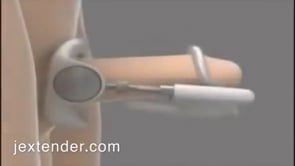 Σύστημα Αύξησης Πέους Jes Extender Original - (Λευκό)