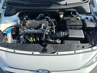 Hyundai i 20 2016-thumb-7