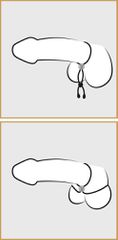 Cock & ball loop-thumb-5
