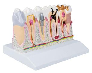 Οδοντιατρικό μοντέλο, 4 φορές το φυσικό μέγεθος - Erler Zimmer