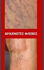 Ιατρικές Βδέλλες-thumb-4