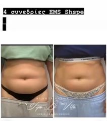 EMS SHAPE-thumb-4