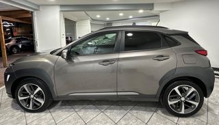 Hyundai Kona 2018 ΔΕΡΜΑ-KEY LESS-ΑΕΡΙΖΟΜΕΝΟ ΣΑΛΟΝΙ-thumb-4