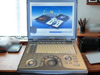 GE LOGIQ e φορητός υπερηχοτομογράφος με 2 κεφαλές – νέα μπαταρία