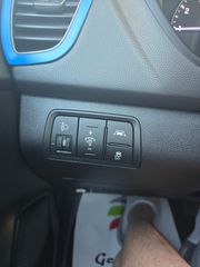 Hyundai i 20 2016 ΓΡΑΠΤΗ ΕΓΓΥΗΣΗ ΑΤΡΑΚΑΡΙΣΤΟΥ ΜΗΧΑΝΗΣ ΧΙΛΙΟΜΕΤΡΩΝ-thumb-29