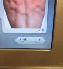 Διοδικό laser αποτρίχωσης Soprano ICE-thumb-7