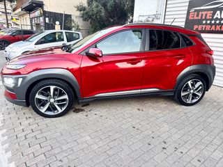 Hyundai Kona 2018-thumb-3