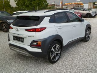 Hyundai Kona 2019 1.0 T-GDI Xpossible-thumb-5