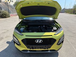 Hyundai Kona 2017 ΑΝΑΛΥΣΗ ΦΠΑ*ΘΕΡΜΑΙΝΟΜΕΝΑ*ΚΑΜΕΡΑ*ΖΑΝΤΕΣ*CRUISE*ΠΡΟΒΟΛΕΙΣ-thumb-30