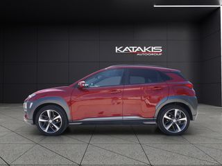 Hyundai Kona 2019 Style|Leather Upholstery|Clima|Rear Camera|Alu|Apple-Android-thumb-7