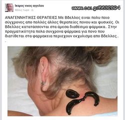 Ιατρικές Βδέλλες-thumb-10