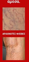 Ιατρικές Βδέλλες-thumb-12