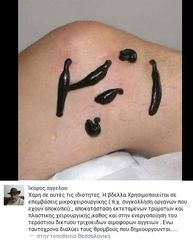 Ιατρικές Βδέλλες-thumb-19